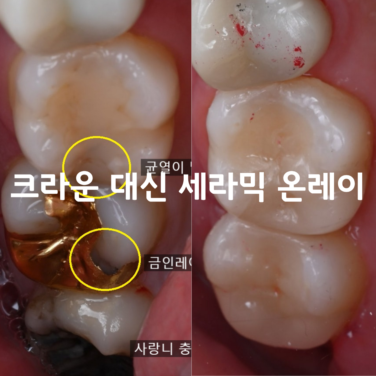 [치료사례] 