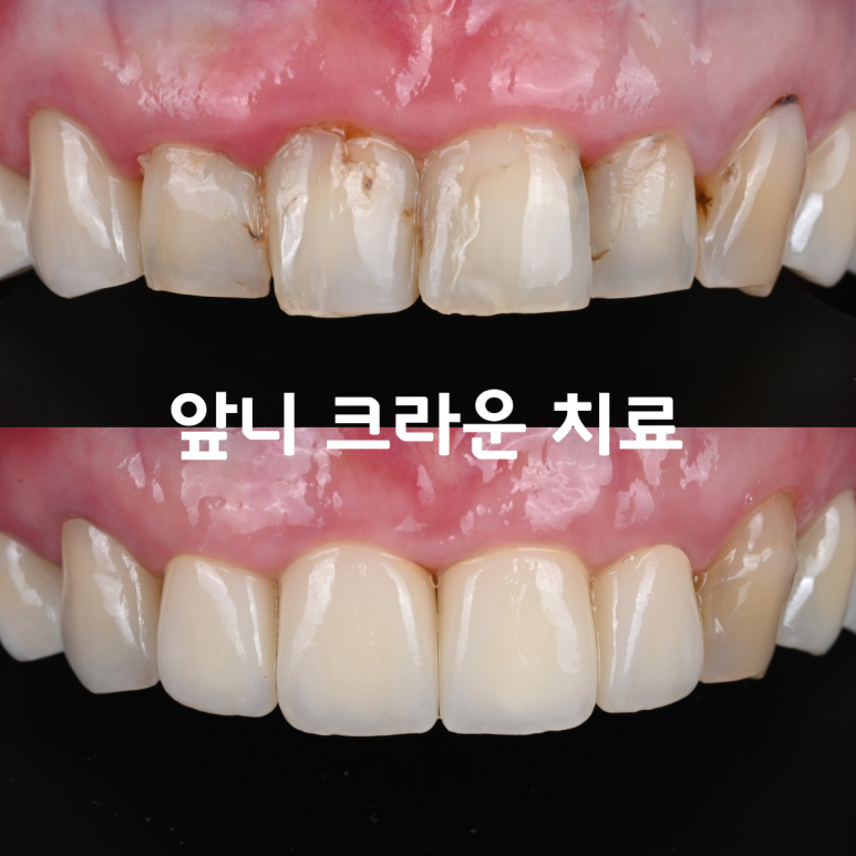 [치료사례] 